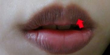 嘴唇的正常颜色的图片图片