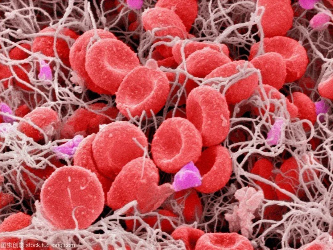 新冠肺炎发现新的危险因素病毒导致凝血触发中风危险