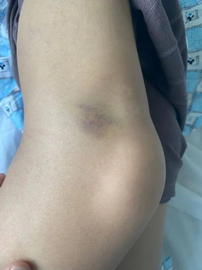 长春中日联谊医院女护士自曝被患者母女打伤67寻证人