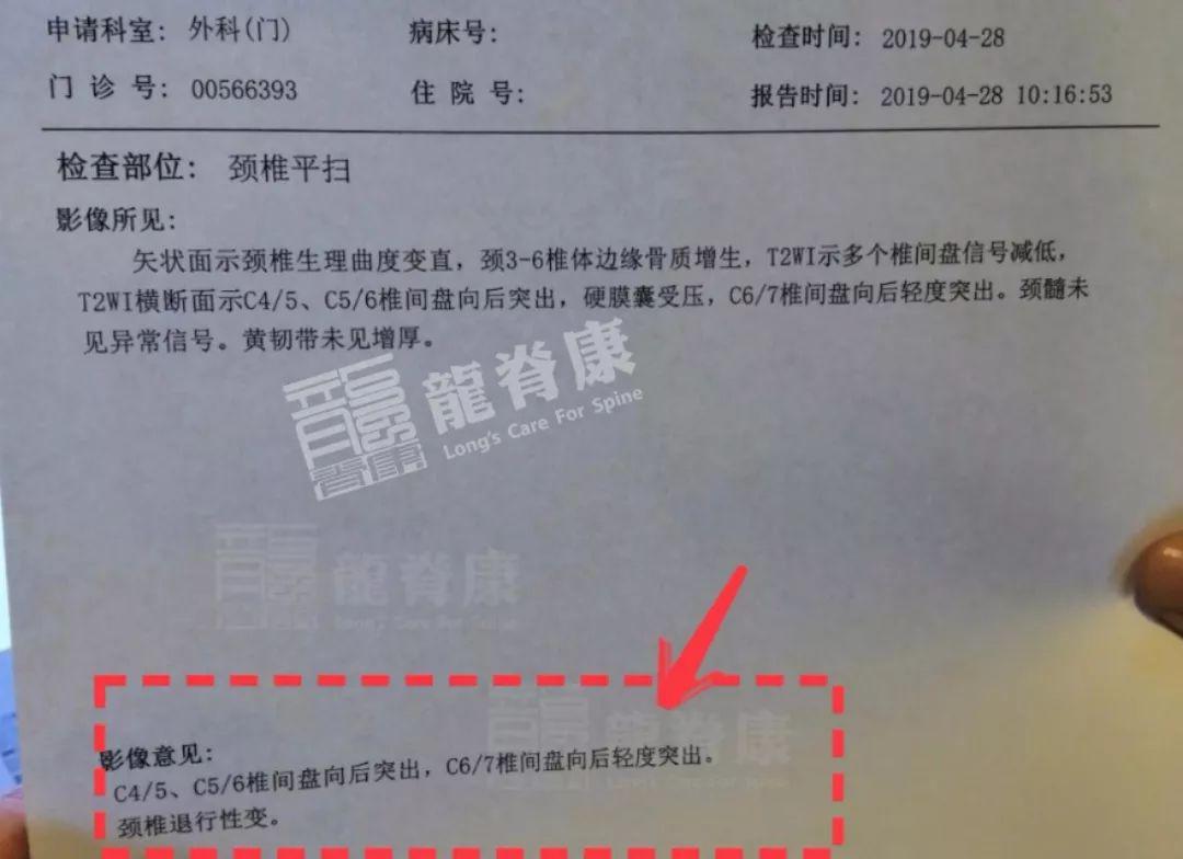 21外院頸椎正側位dr閱片示:頸椎生理曲度變直,頸椎多棘突偏歪.