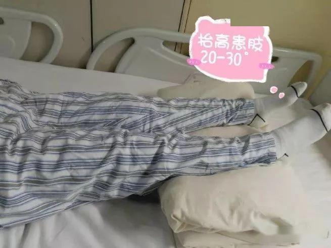 血栓—血管里的"格格巫"_下肢