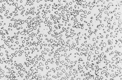 球状珠光体,经球化退火获得,渗碳体成球粒状分布在铁素体基体上;渗碳