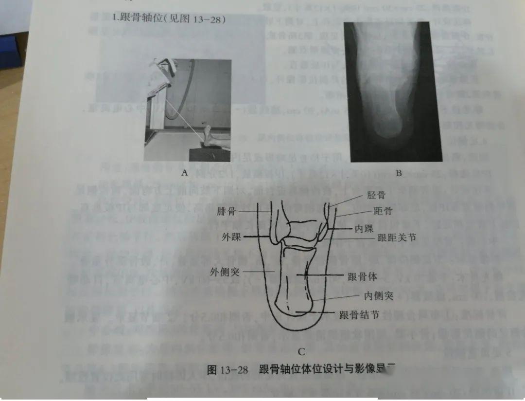 跟骨轴位(被检者坐于摄影台,被检侧下肢伸直,足尖向上,稍内旋,踝关节