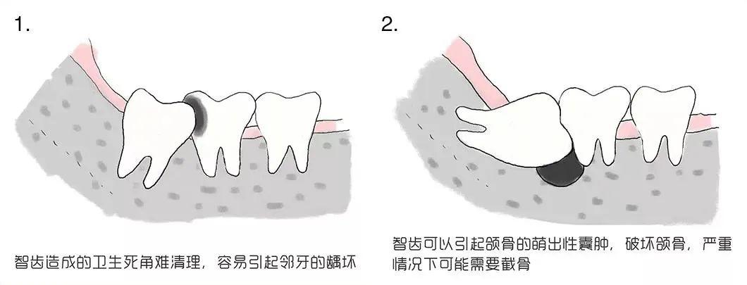 牙痛都因上火火這鍋我不背