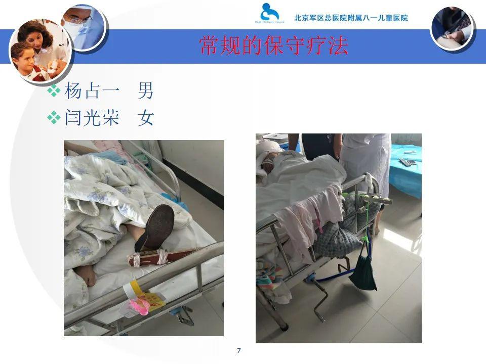 ppt股骨颈骨折的新型保守治疗方法