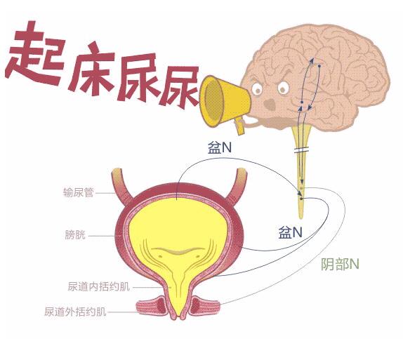 遗尿症绝不是儿童的专属,18岁小伙还在画"地图"为啥?魏县安康医院