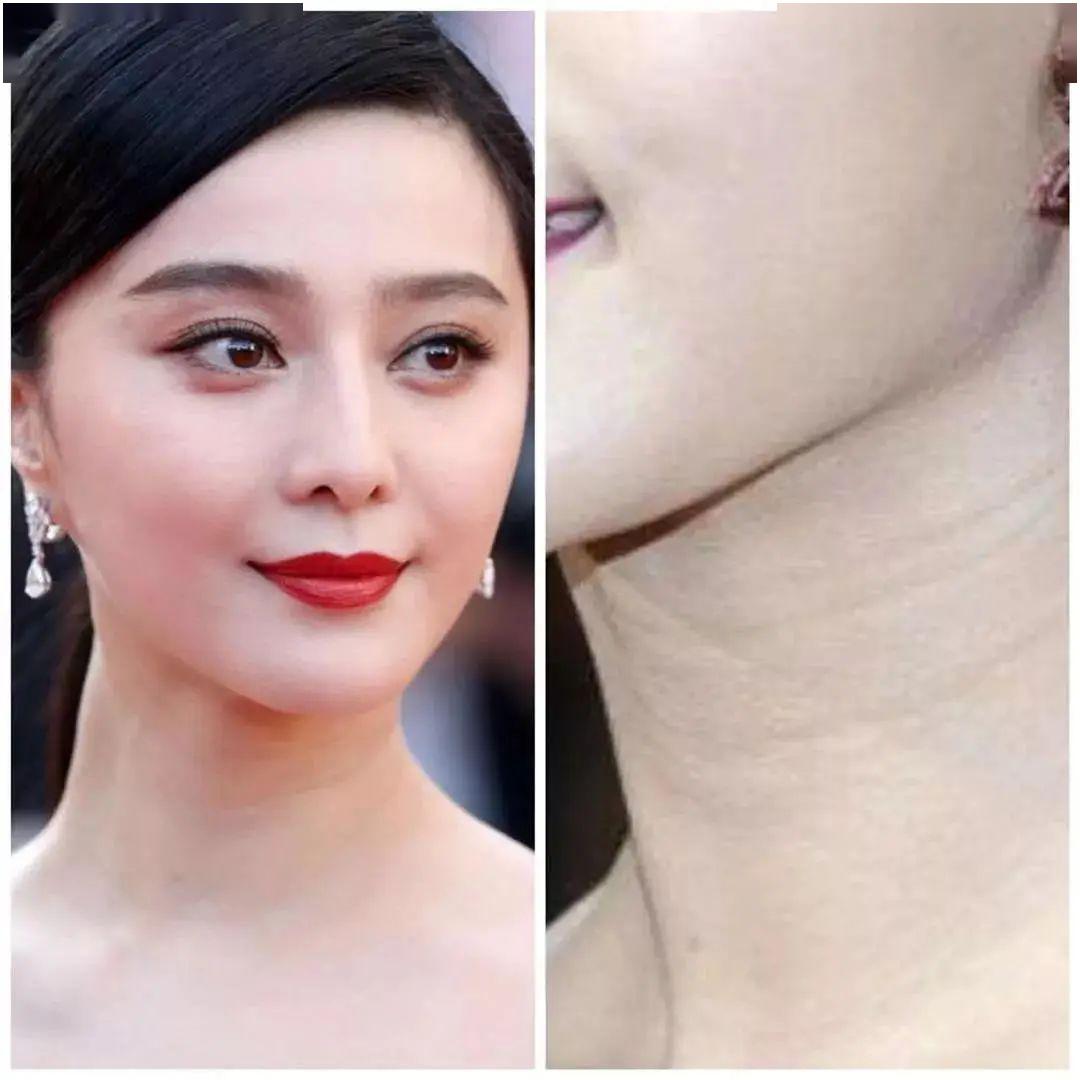 就连平时保养得当的范爷都逃不了"颈纹"的威胁,何况我们普通人!