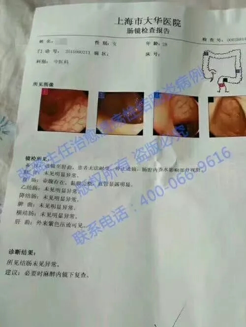 專欄慢性腸炎能夠治的好麼如何治