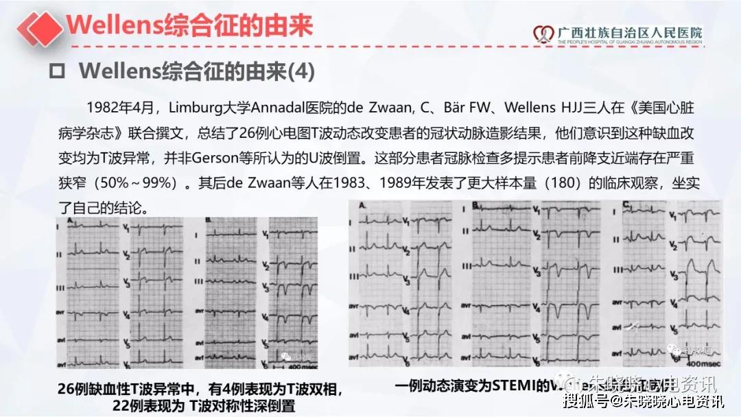 dewinter综合征与wellens综合征张雅莉广西自治区人民医院