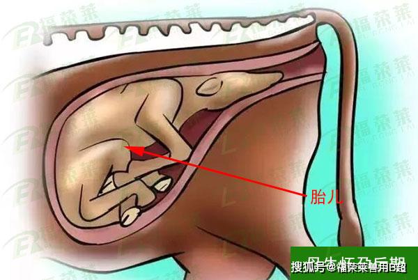 母牛验胎教程图片