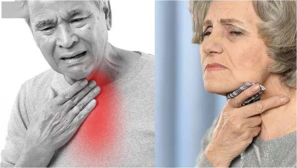 造口等各类经管进食方式都是在「提供营养」,不是在「治疗吞咽障碍」