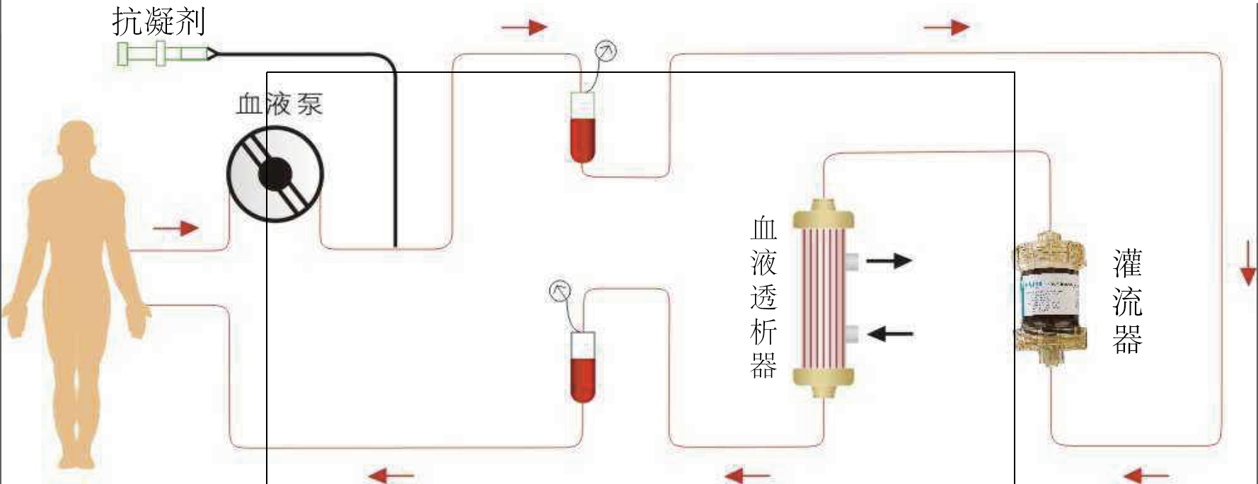 血液灌流安装图图片