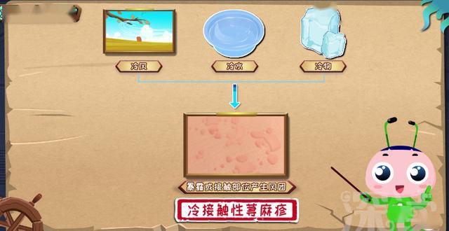 瘙痒红肿反复发作避开7大坑能让荨麻疹滚犊子