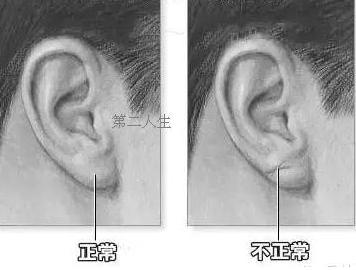 耳垂卷曲面相图片