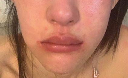 韩版angelababy被打了嘴肿脸歪几近毁容