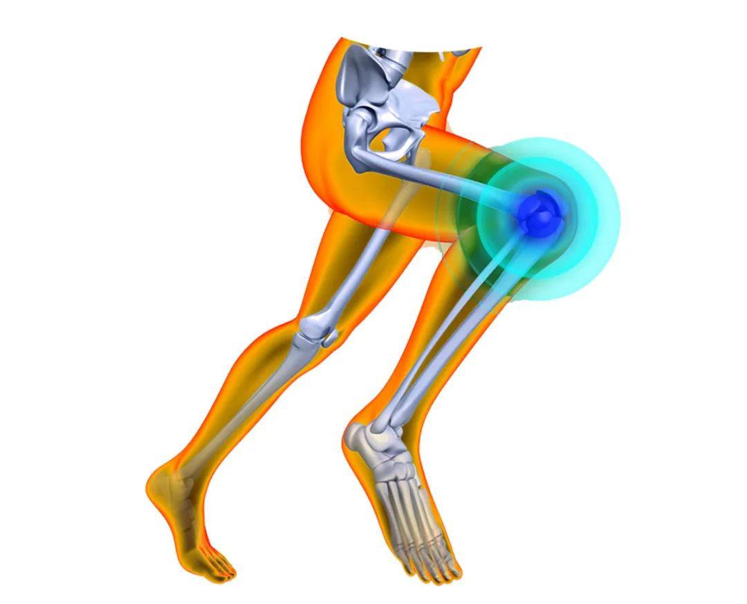 河南省中医院骨病专家:"老寒腿"应采取阶梯疗法_膝关节