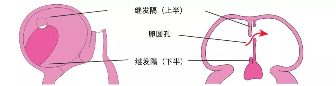 也并不形成一个完整的分隔,因此,仍留下了一个孔道,即卵圆孔(foramen