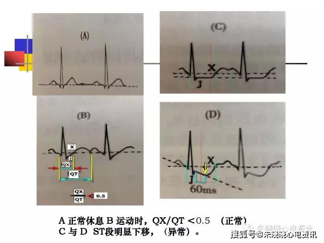 st段下移图片