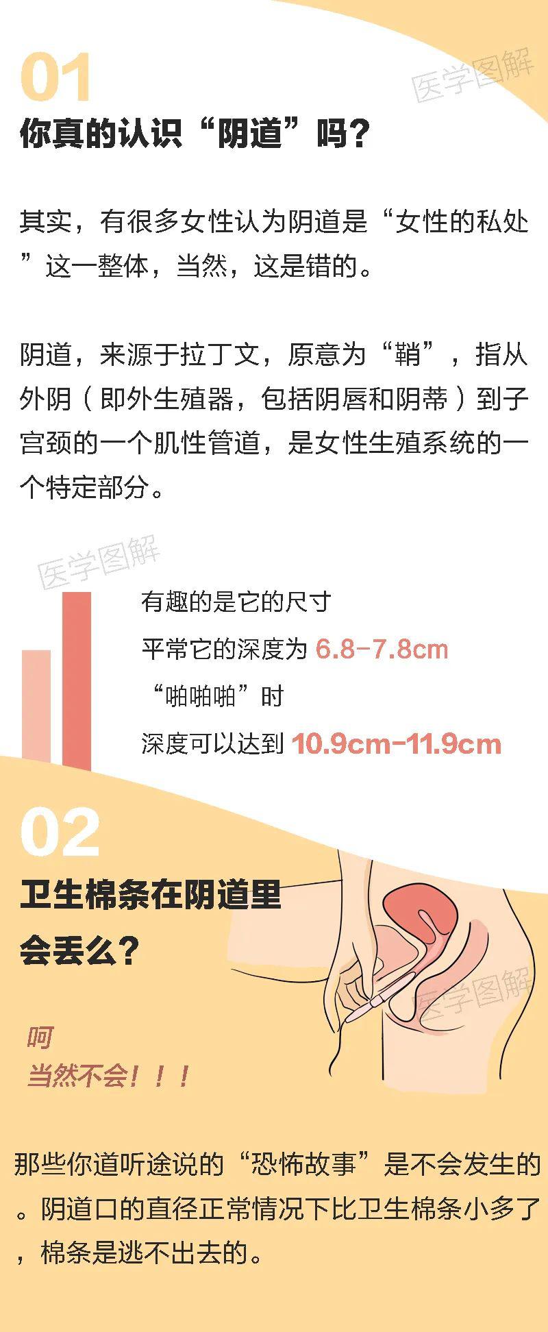 情况下,例如阴道瘘引起的排气便需要就医了,因为这是不正常的一个