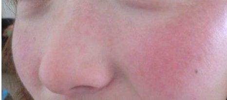 脸越洗越过敏?那是因为你的脸,洗!多!了!