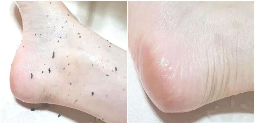 如果不做好清洁的话,很容易造成污垢堆积,角质层增厚,变得暗沉粗糙