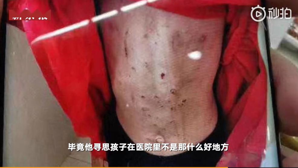 后妈亲爸剪闺女嘴唇你们还是人吗