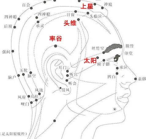 偏头痛就爱脾气差的人,疼时这么刮一刮,瞬间不疼了_刮痧