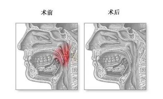 医疗过失还是患者神经症神秘空鼻症引发数起杀医事件