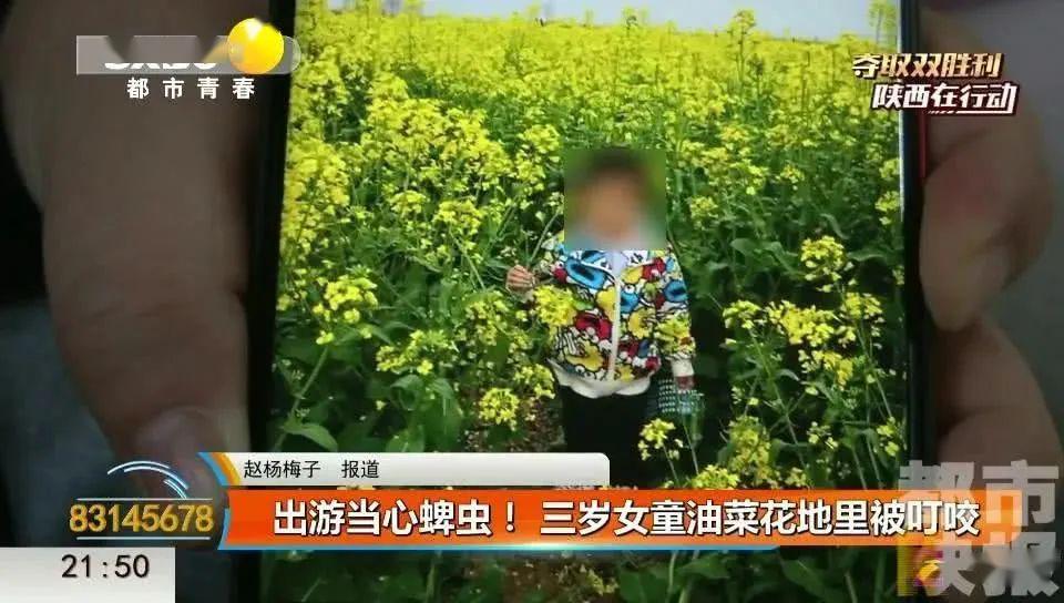 假期出去一定要小心这种虫子3岁女童被叮一口差点没命