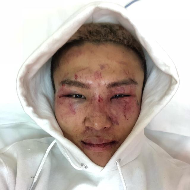 原创中国嘴炮李凯文格斗排名对我没影响目标仍然是世界冠军