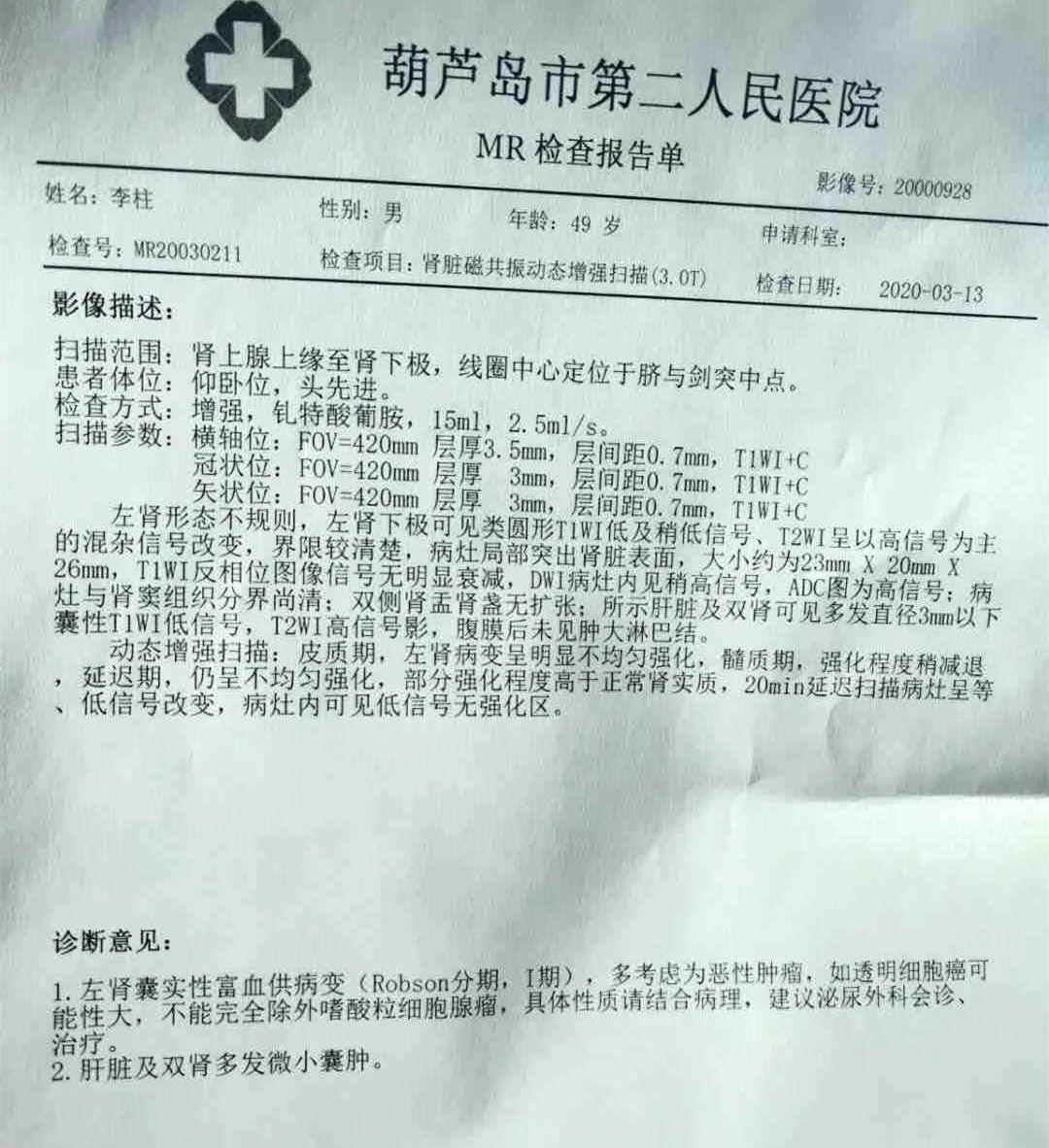 经过一系列检查,父亲检查出疑似肾脏恶性肿瘤,由于当地医院条件不是