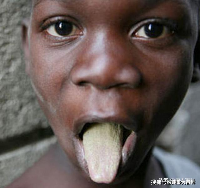 非洲人的吃土习俗,以泥饼为主食,这么吃真的吃不坏吗?