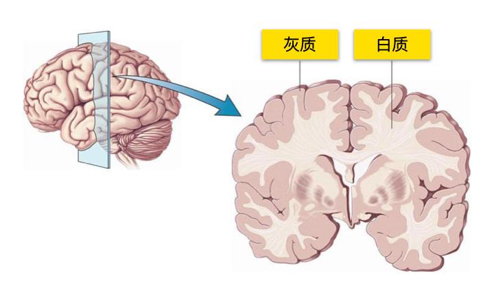 组参与者脑中的与处理和储存复杂视觉运动相关的区域,灰质增加了约3%