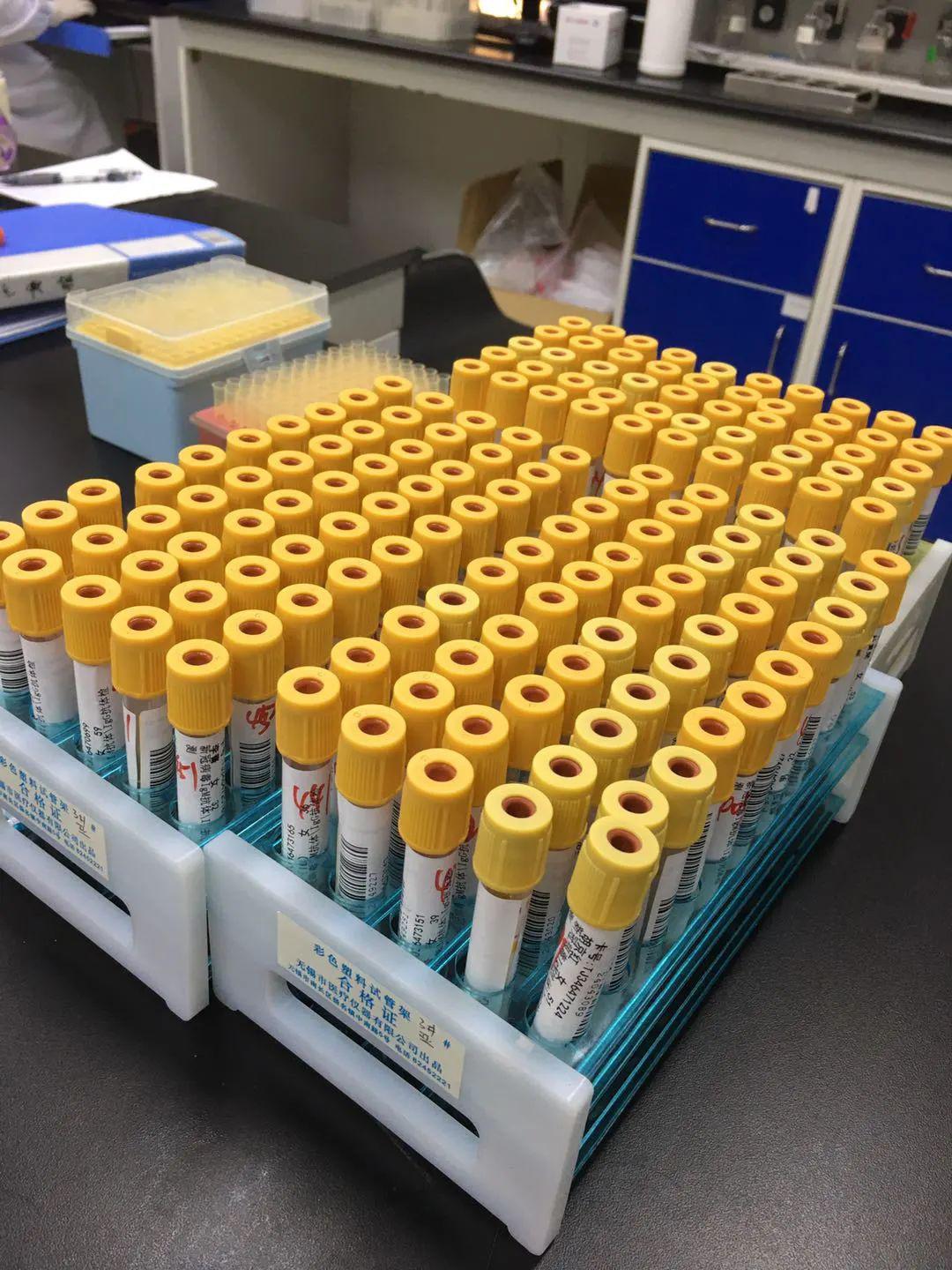 标本接收小组正在编排血液样本,做相关前处理检验中心作为此次血清新