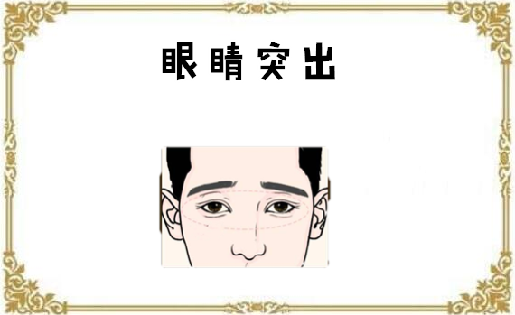 男人金鱼眼面相解析图片