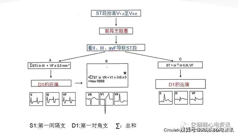 心肌梗死定位九宫格图图片