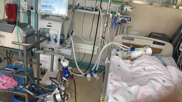 再度启用ecmo抢救呼吸衰竭重症患者这家医院硬核实力赢得生机