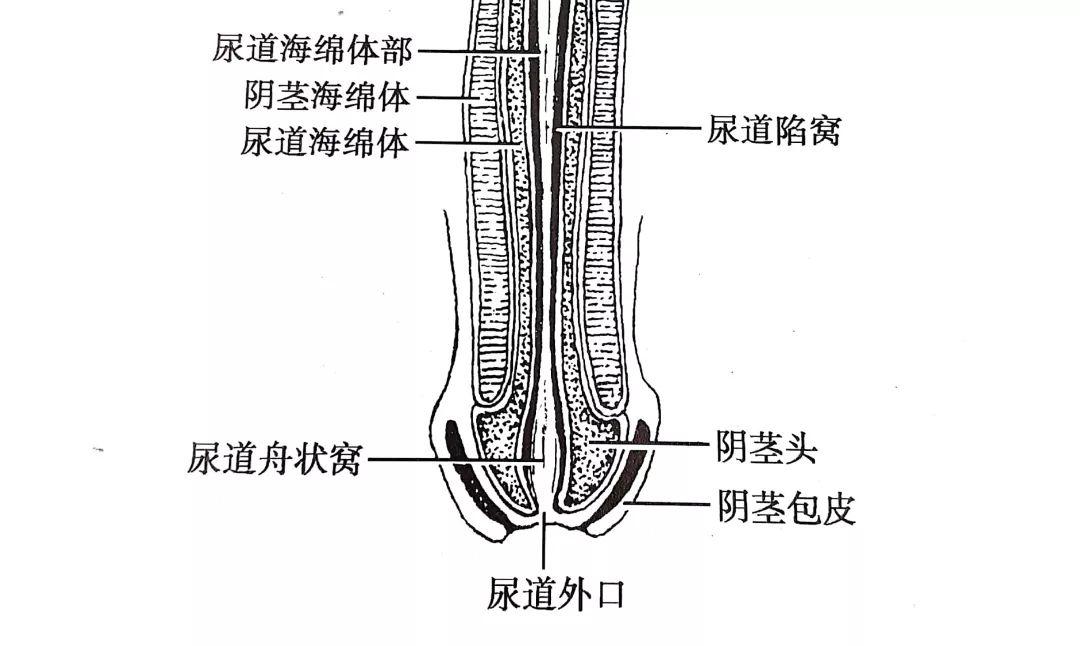 还容易使包皮腔内每次尿尿的时候都得把它翻起来就会盖住尿道口如果