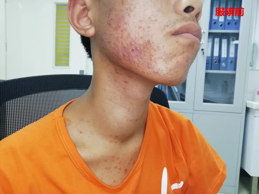 是什么让13岁少年心慌手抖了四年