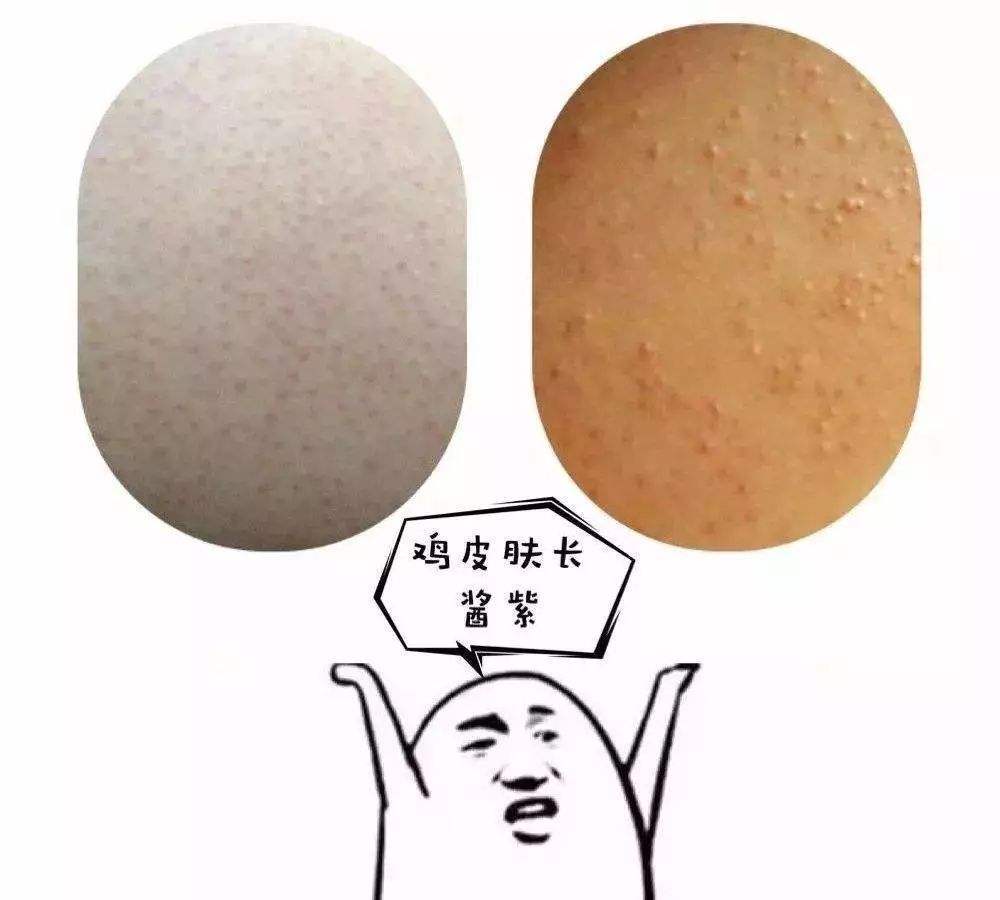 女孩青春期突然变成鸡皮肤(女孩青春期突然变成鸡皮肤怎么回事)