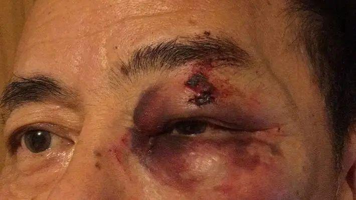 新西兰华人记者街头被打疑因种族歧视奥克兰凶杀案死者