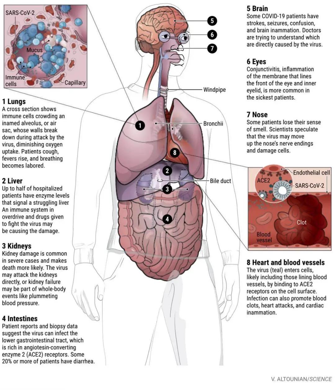 新冠病毒侵入人体全过程!