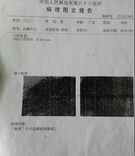 食管癌病历模板图片