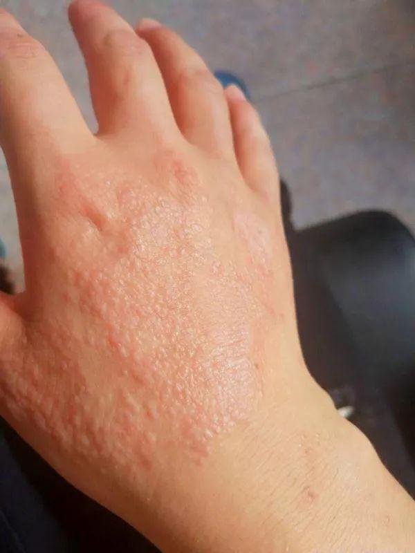 说  日夜苦练  这双手的主人朱宛张是铺路工 一年至少有300天 和水泥