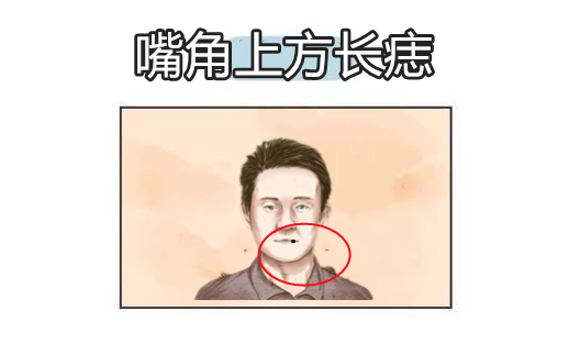 男人也有克妻痣