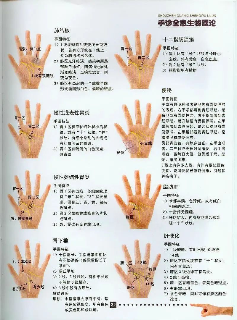 全息辨证学简述:张仲景的六经辨证是纵横辨证,叶天士的卫气营血辨证是