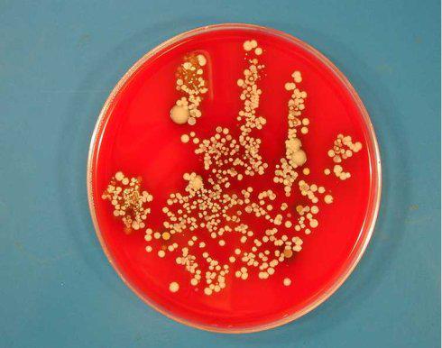 1天后生成的细菌来看看这只培养皿中的手印长期不洗手会怎么样?
