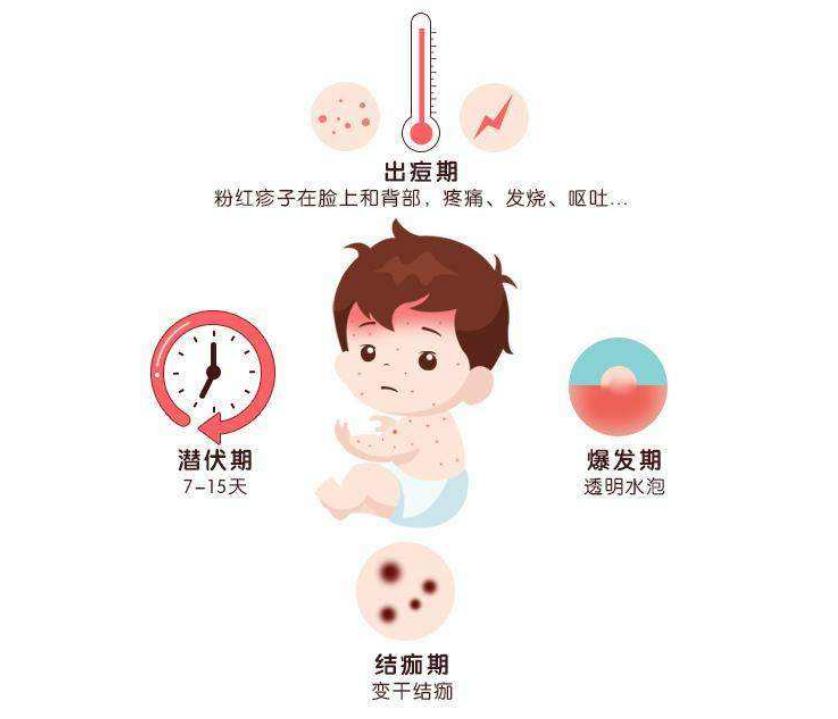 重要提示!_水痘