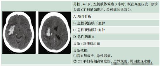 記憶:腦出血=實質內的高密度影,常伴中線移位5.