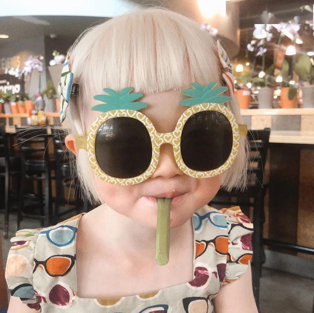 身患白化病的中国女孩,背后的故事令人泪目